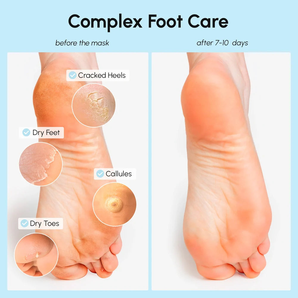Exfoliating & Hydrating Foot Mask